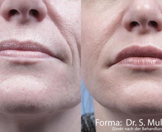 Forma_Face_DtTxt Forma_Face_DtTxt